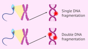 Tipi di frammentazione del DNA spermatico